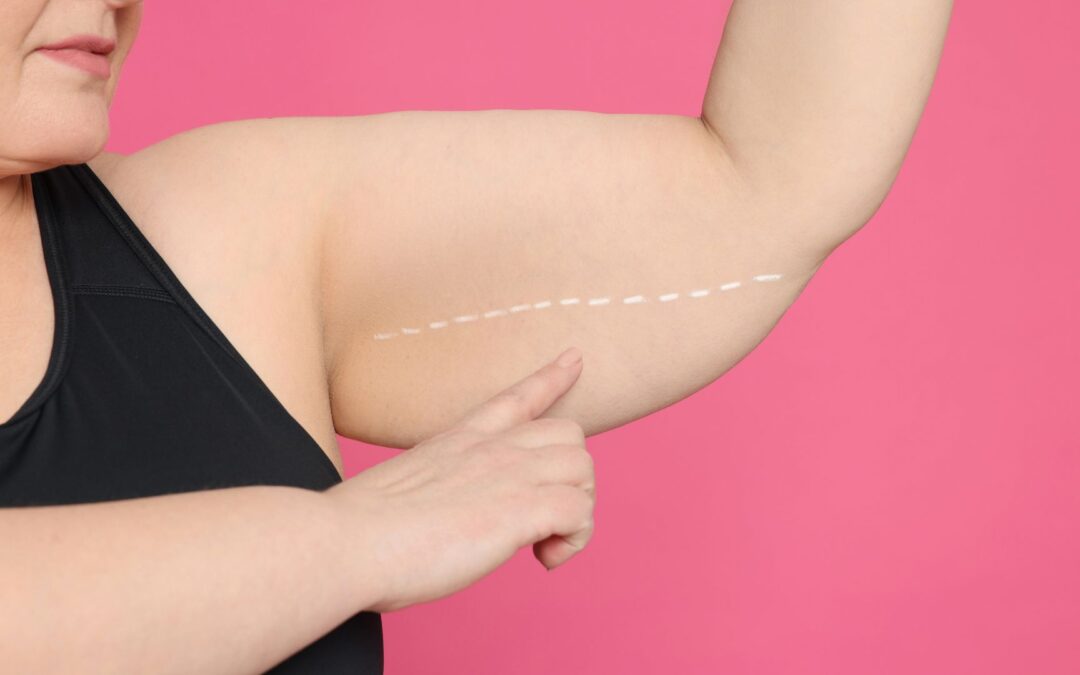 Affordable Bariatric Surgery: Financing and Payment Options Explained