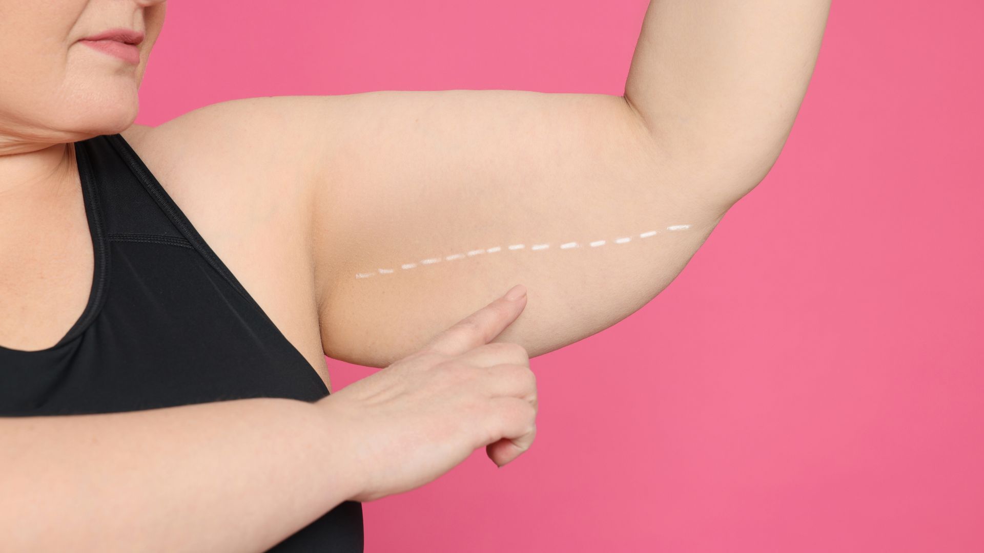 Affordable Bariatric Surgery: Financing and Payment Options Explained