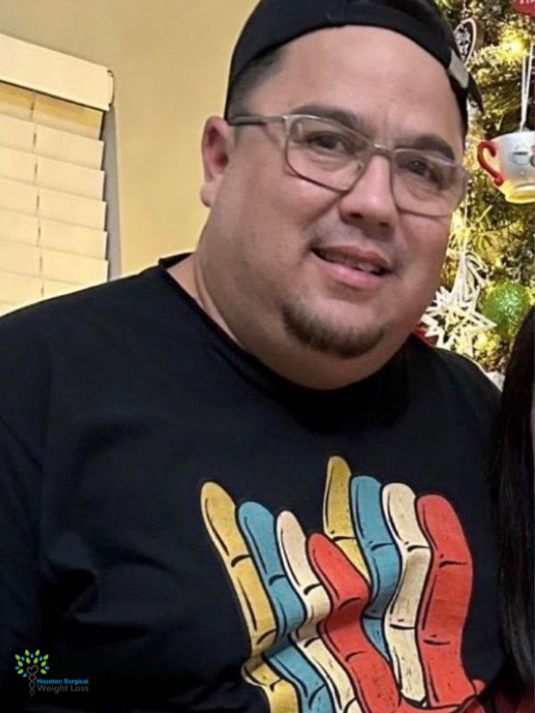 before and after weight loss