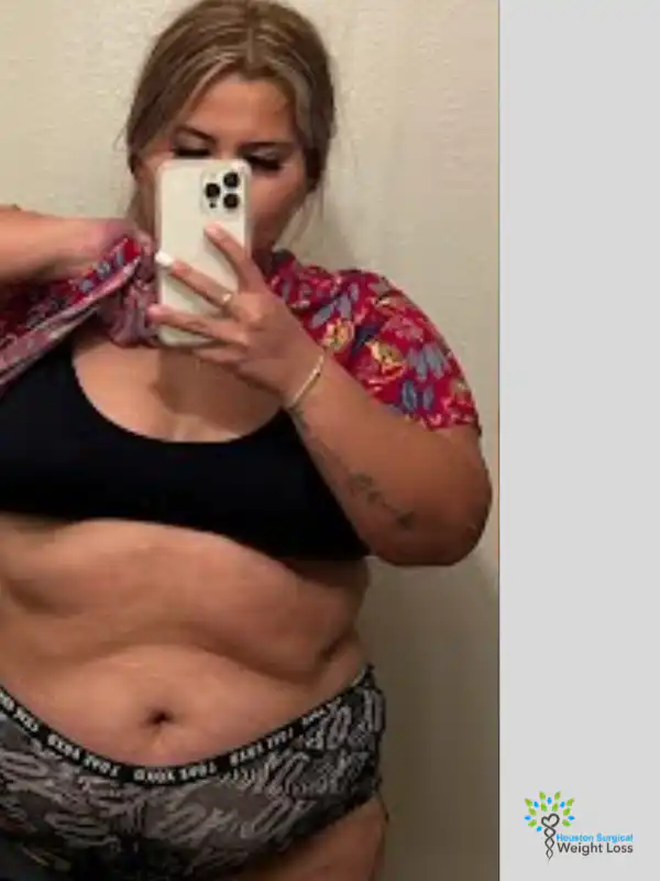 before and after weight loss