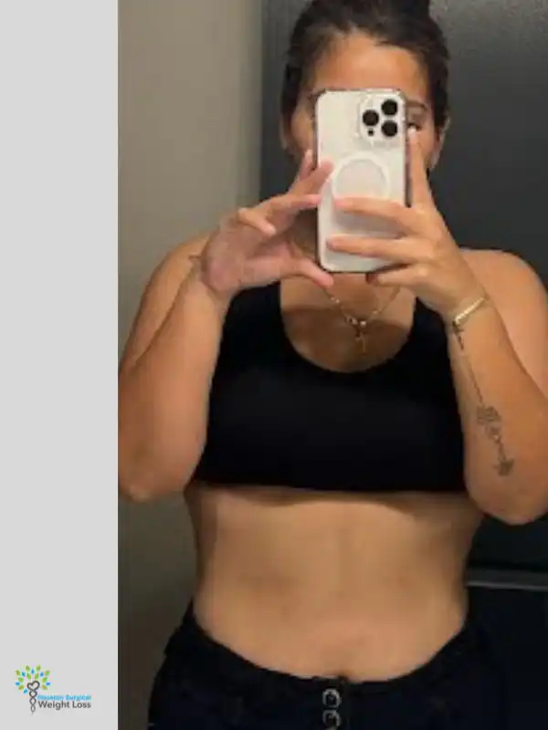 before and after weight loss (5)